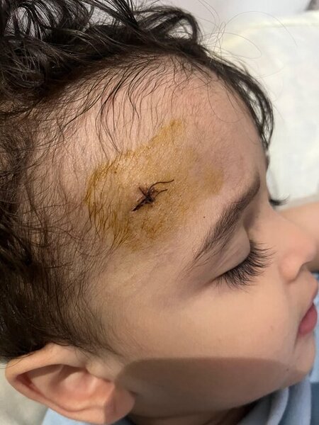 "Etimad KİDS" bağçasında uşağın başı yarıldı, ailəsinə xəbər verilmədi (FOTO)