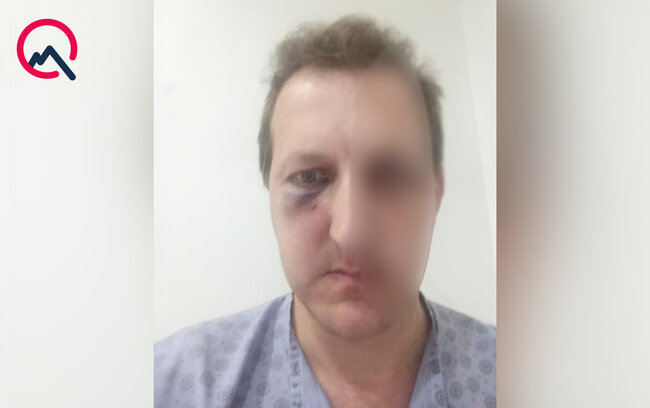 Xalq artistinin oğlunun döyülməsinə görə daha 2 şəxs saxlanıldı