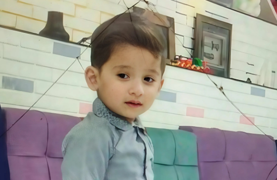 Azərbaycanda beş yaşlı uşaq diş əməliyyatından sonra ÖLDÜ