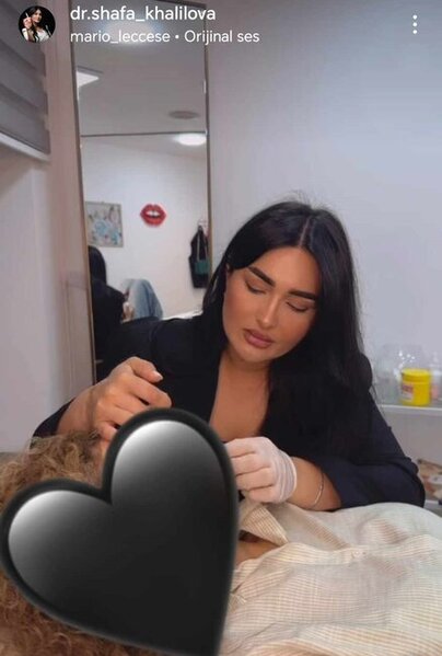 Şəfa Xəlilova dolğu,inyeksiya, botox prosedurlarını necə icra edir? -Fotofaktlar