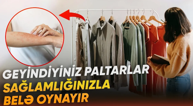Üzdə şişkinlik, dəridə səpkilər: Səbəb geyiminizdə gizlənə bilər - VİDEO