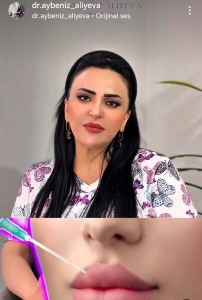 Aybəniz Əliyeva özünü "doktor" kimi təqdim edərək inyeksiya edir? Hicama kursuna görə sertifikat verir? -Fotofakt