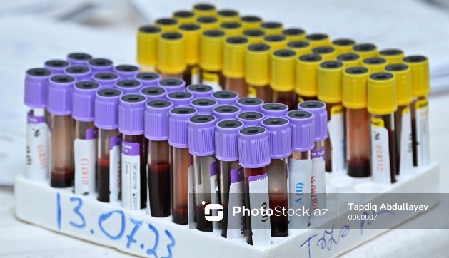 Hepatit B, C və digər qaraciyər xəstəliklərinin müalicəsində edilən səhvlər hansılardır?