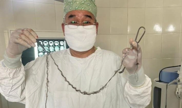 Görülməmiş hadisə:Qızın saçı 8 il içəriyə doğru uzanıb