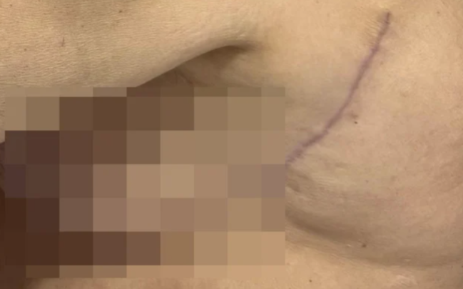 "Könül Ağamirova məni 3 dəfə əməliyyat edib pis vəziyyətə qoydu" (FOTO)