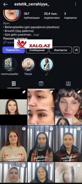 "Aristokrat" klinikasında işləyən "doktor" Şölə pasiyentləri necə aldadır-Fotofakt