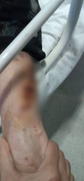 Xəzər Tibb Mərkəzində xəstəyə işgəncə verilib? - RƏSMİ AÇIQLAMA + FOTO