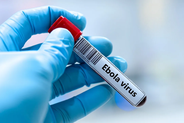 İsraildə Ebola təşvişi: Bir nəfər nəzarət altına alınıb