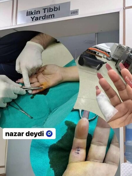 Aktrisa Xəyalə TƏCİLİ ƏMƏLİYYAT OLUNDU - FOTO