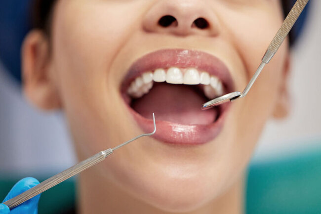 İnsanda yenidən diş çıxaran preparat hazırlandı