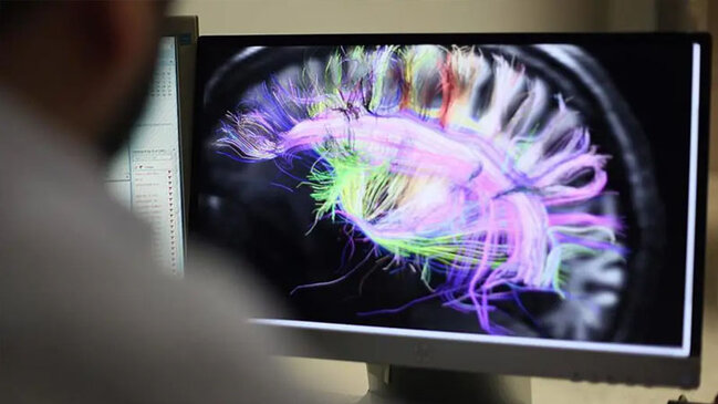 Eqoizmin müalicəsi tapılmış ola bilər - Alimlərdən yeni tədqiqat