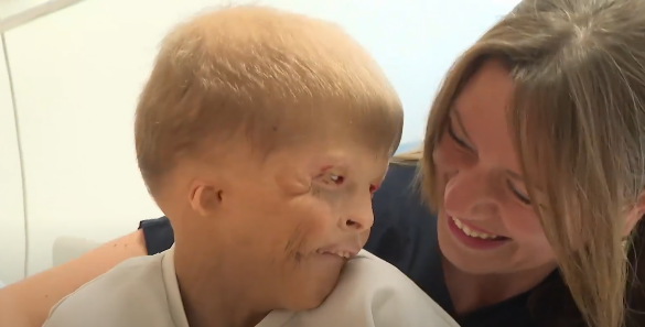 Türkiyədə ukraynalı uşağa öz toxumalarından qulaq hazırlanacaq