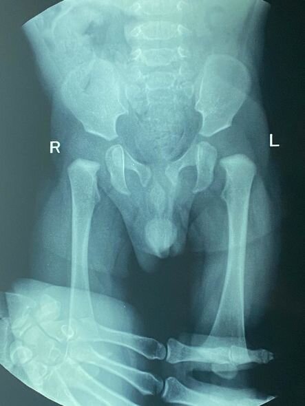 8 aylıq Zeydin müalicəyə ehtiyacı var: "Maddi cəhətdən tam tükənmişik" - FOTO