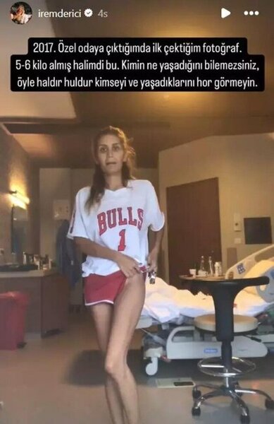 30 yaşlı Nihal Candanın ölümündən sonra 2 məşhurdan ŞOK anoreksiya ETİRAFI