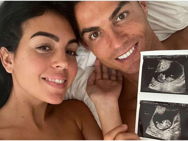 2021-in ən çox bəyənilən paylaşımları... - FOTO