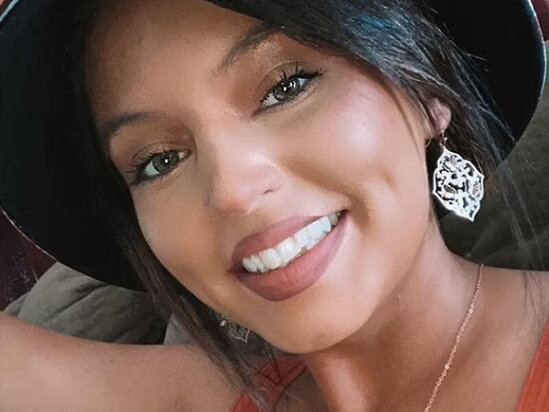 Dodağına gel doldurdu, dodağı çürüdü - FOTO