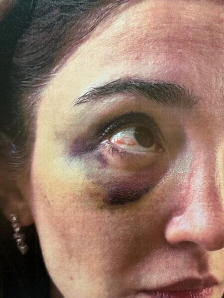 Məzahir Pənahovun oğlu xanımına işgəncə verib - Ağır ittihamlar