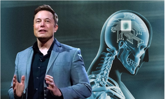 "Neuralink" klinik sınaqlar və insan çipinin İmplantasiyası üçün təsdiq alır