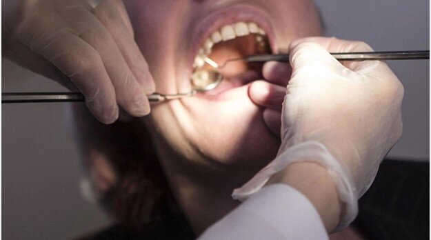 Dişlərini itirənlərə şad xəbər - yenidən diş yetişdirmək mümkün olacaq