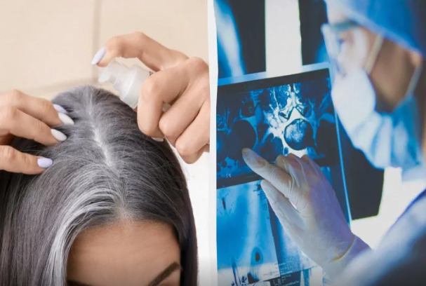 Ağ saçlara görə narahat olmayın: Saçların qocalmasının gözlənilməz funksiyası kəşf edildi