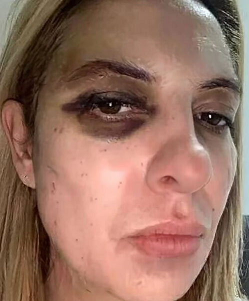 Keçmiş prezident arvadını görün NƏ HALA SALDI - FOTOLAR