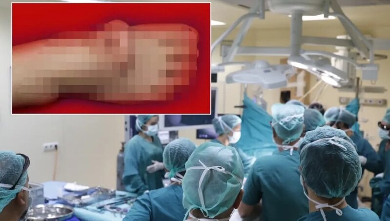 Beş ay müddətində qulağını ayağında daşıdı - FOTO