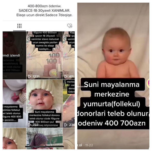 Azərbaycanda 800 manata orqan satışı: Qadınlar dönüşü olmayan təhlükə ilə üz-üzədirlər - FOTO