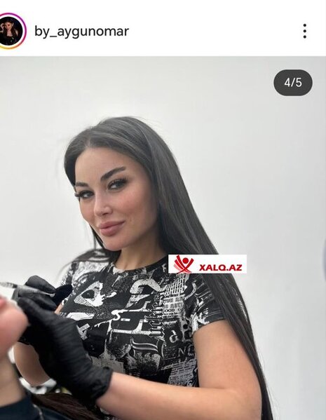 Kosmetoloq Aygün Ömərova lisenziyasız nece inyeksiya prosedurlarını həyata keçirir?