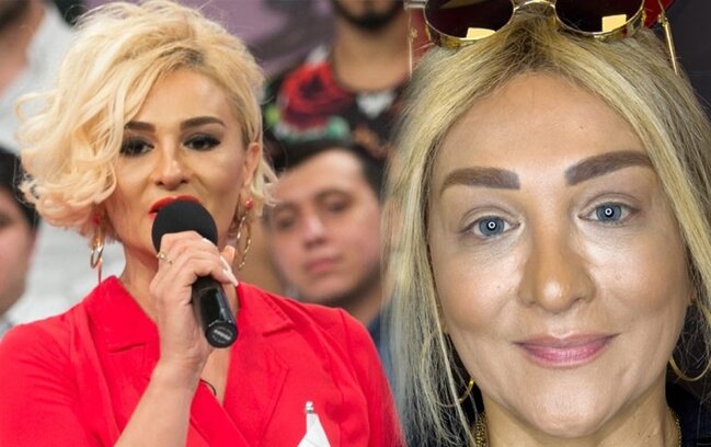 Mətanət əməliyyatla göz rəngini dəyişdirdi - Fotolar