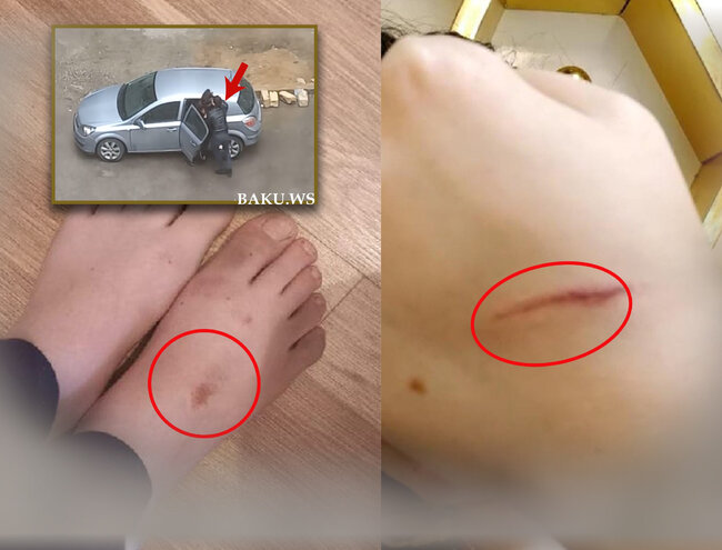 Küçədə qaçırılan qadınla bağlı ŞOK DETALLAR - Gələn gündən şiddət görür - FOTO - YENİLƏNİB