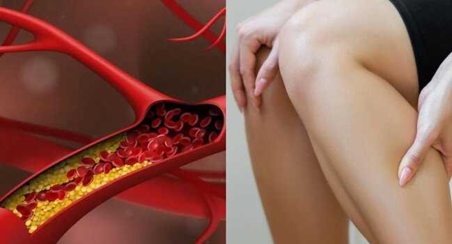 Qan laxtalanması problemi genetik imiş