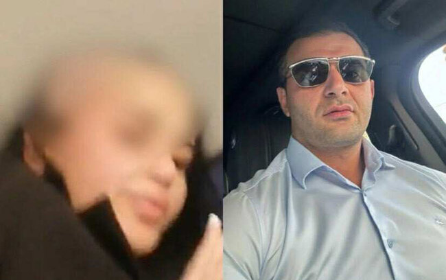 Arvadının saçını keçəl edən ər - Həbs olundu