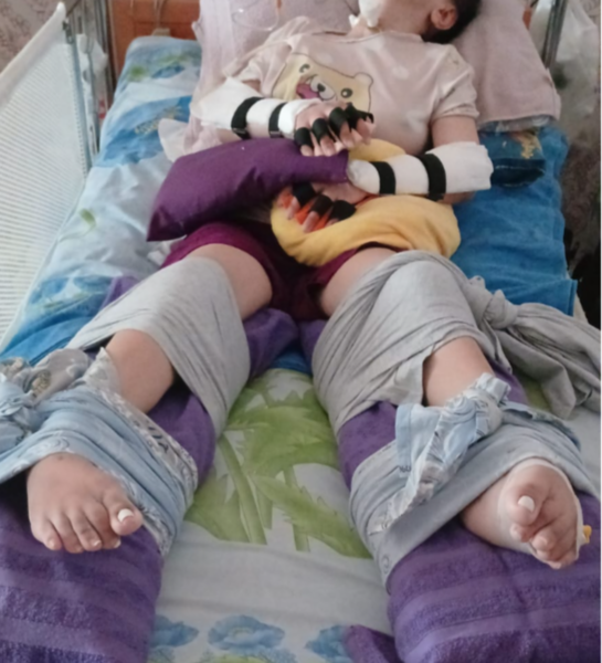 "MedAura" klinikasında Yaqub Əsədinin səhv əməliyyatı: Gənc qız komaya düşdü