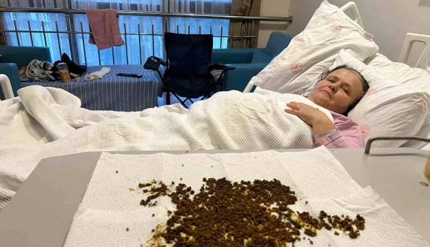 Türkiyədə pasiyentin öd kisəsindən 20 mindən çox daş çıxarıldı