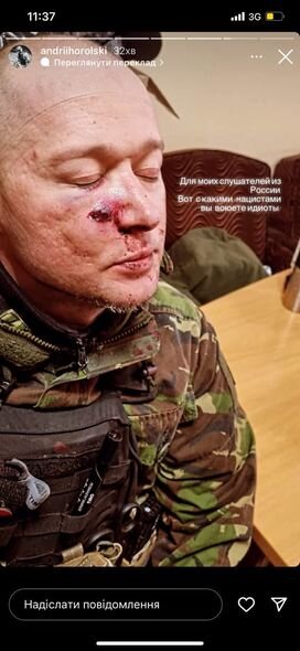 Könüllü olaraq ölkəsini müdafiə edən ukraynalı musiqiçi yaralanıb - FOTO