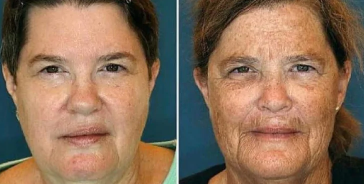 Əkizlərin fotoları YAYILDI: Onlardan biri niyə daha GƏNC GÖRÜNÜR? - FOTO