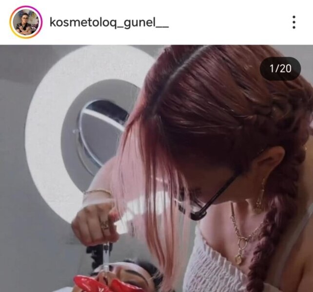 "Kosmetoloq" Günel Muxtar necə inyeksiya prosedurlarını həyata keçirir? -Araşdırma