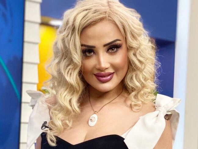 Məleykə Əsədova estetik əməliyyatdan sonra BELƏ OLDU - VİDEO