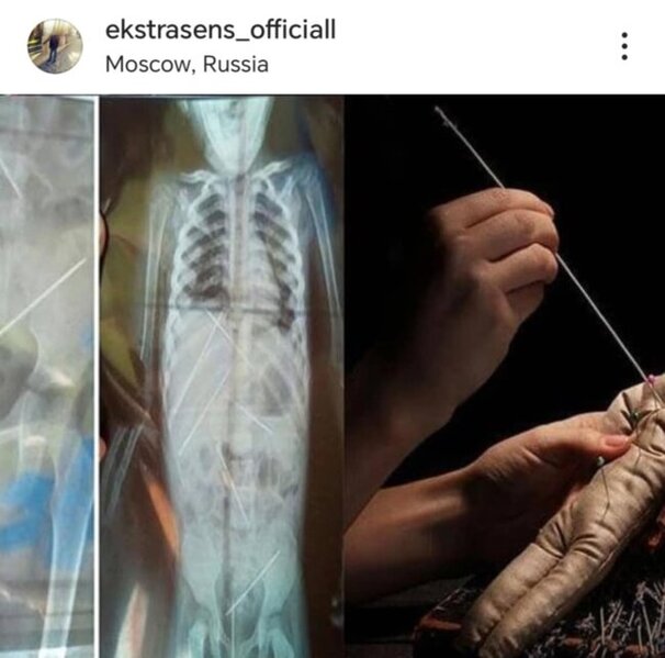 "Ekstrasens Etibar" ritualları ilə kimlərdən "CİN" çıxarıb? -Araşdırma