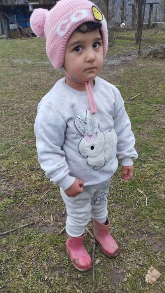 İki yaşlı Dənizin dəstəyə ehtiyacı var: "Müalicələrini davam etdirməyə imkanımız yoxdur" - FOTO