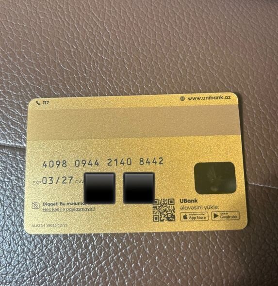 Bədəni yanan daun sindromlu körpənin anası: "Müalicəni etmək üçün imkanımız yoxdur" - FOTO