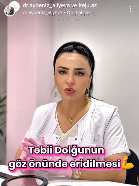 Aybəniz Əliyeva özünü "doktor" kimi təqdim edərək inyeksiya edir? Hicama kursuna görə sertifikat verir? -Fotofakt