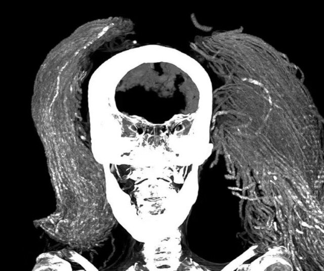 3500 il əvvəl yaşamış "Qışqıran qadın": Orqanları hələ də YERİNDƏDİR - FOTOLAR