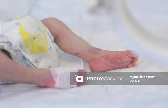 Britaniyada nadir hadisə: Ölən donordan orqan köçürülən qadın ana oldu