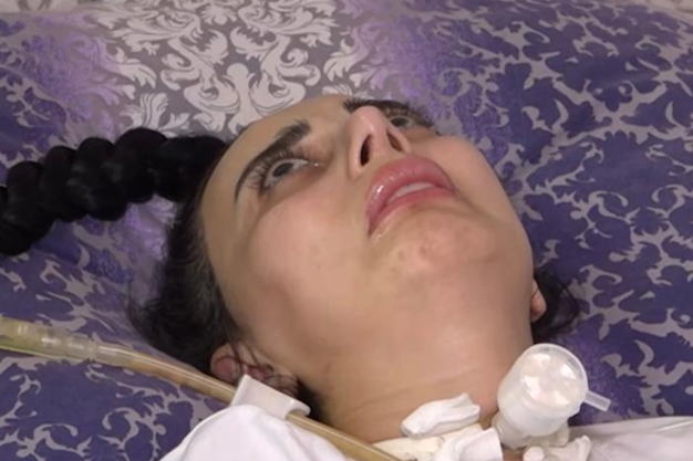 Burun əməliyyatına sağlam girib iflic olaraq çıxdı: Cərrah isə aparatın işləmədiyini deyir