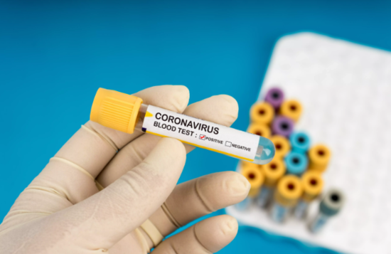 Azərbaycanda koronavirusa yoluxanların statistikası