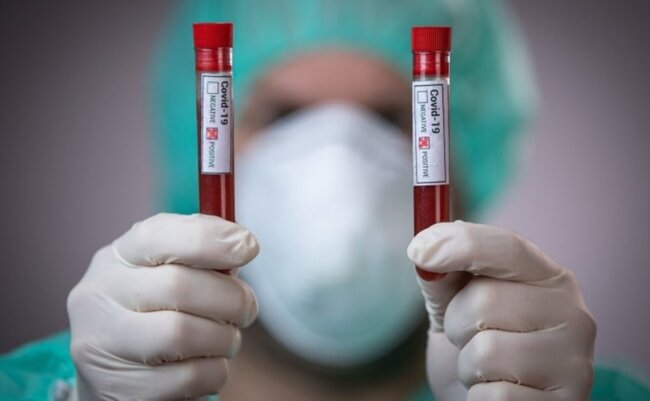 Bu günə olan yoluxma sayı