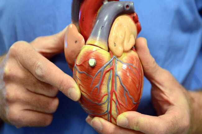 İsti havalarda ürək xəstəliklərindən necə qorunaq? - HƏKİM DANIŞDI