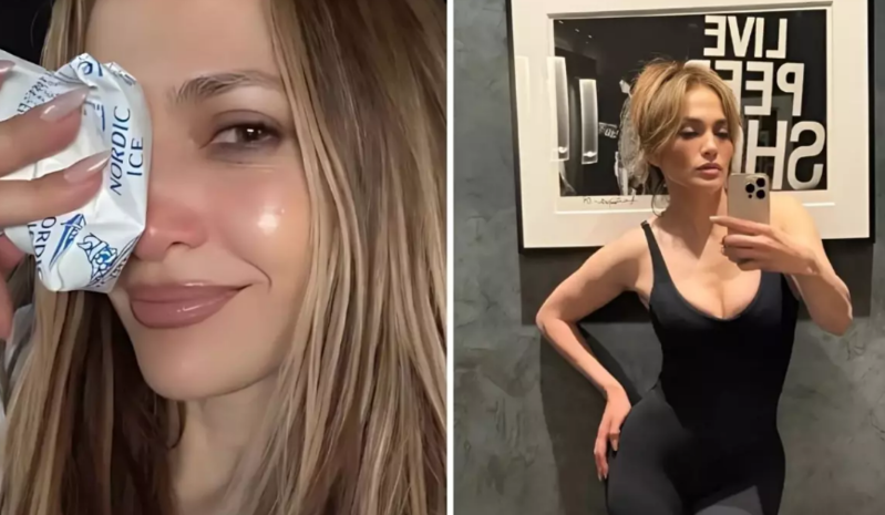 Jennifer Lopez məşhur mükafat şousunun məşqləri zamanı üzündən xəsarət aldı - FOTO