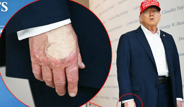 Ağ Evin sirri: Trampın əlindəki göyərti yenidən diqqət mərkəzində